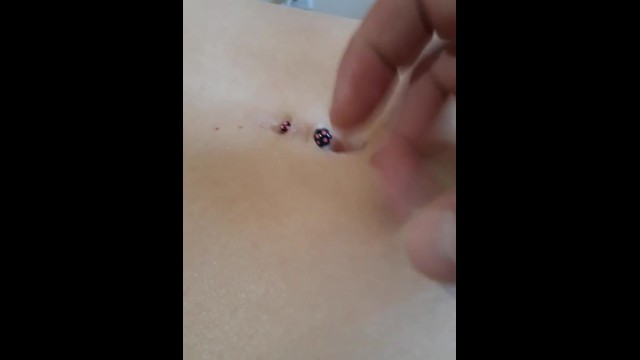 removing dried wax from deep navel