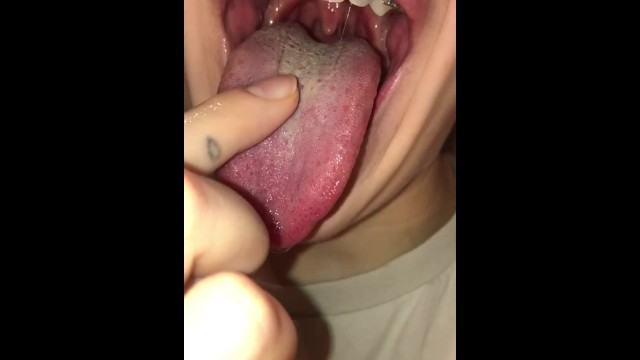 Endosccope deep into mouth. women with braces gags. Uvula bdsm